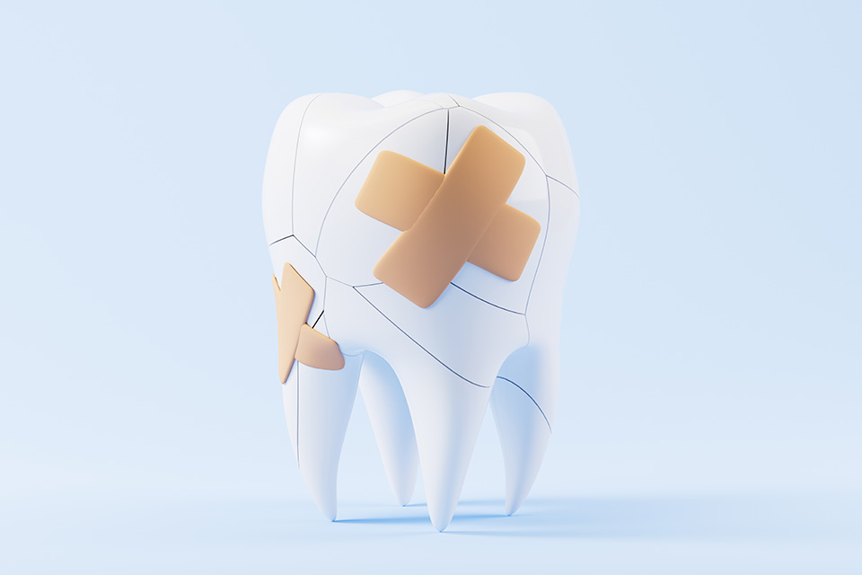 Global Header # 2 Broken Tooth